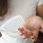 How To Stop Hair Falling