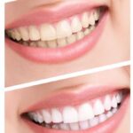 Easier to keep teeth shining and healthier